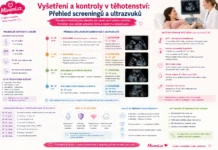 Vyšetření a kontroly v těhotenství - přehled screeningu a ultrazvuku